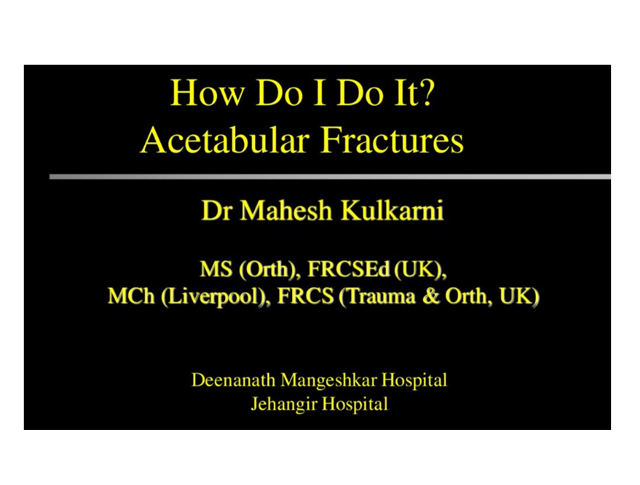 How Do I Do It? Acetabular Fractures