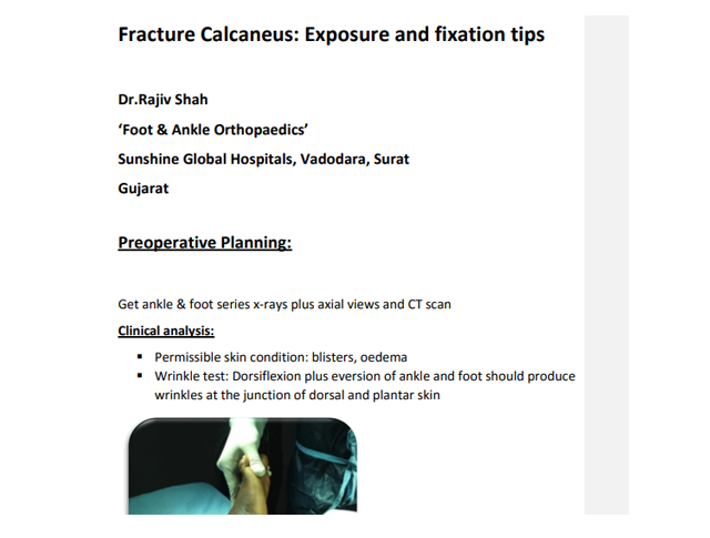 Fracture Calcaneus : Exposure and fixation tips