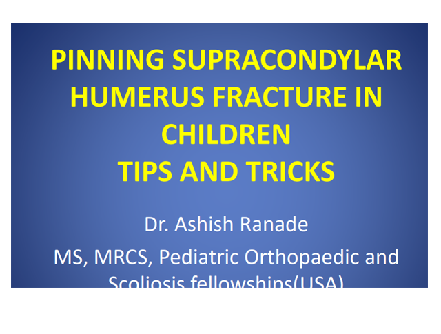 Pinning Supracondylar Humerus Fracture In Children Tips And Tricks