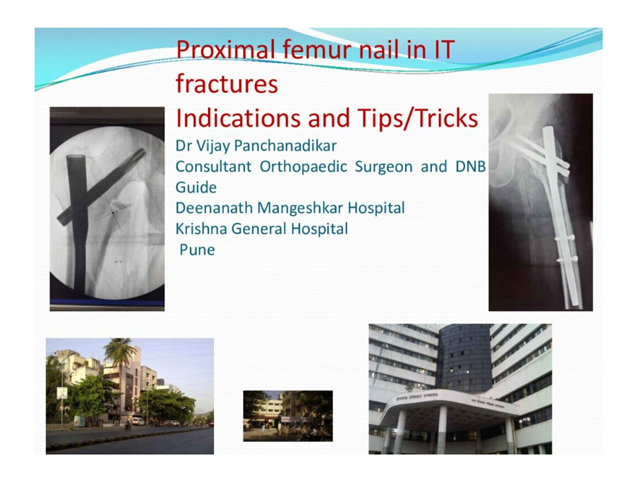 Proximal Femur Nail in IT Fractures Indications and Tips/Tricks